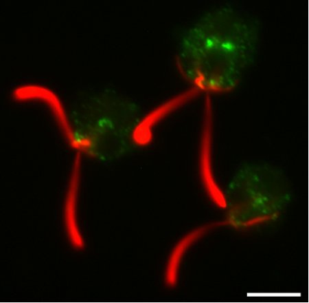 immunolocalization using anti-clathrin heavy chain antibody